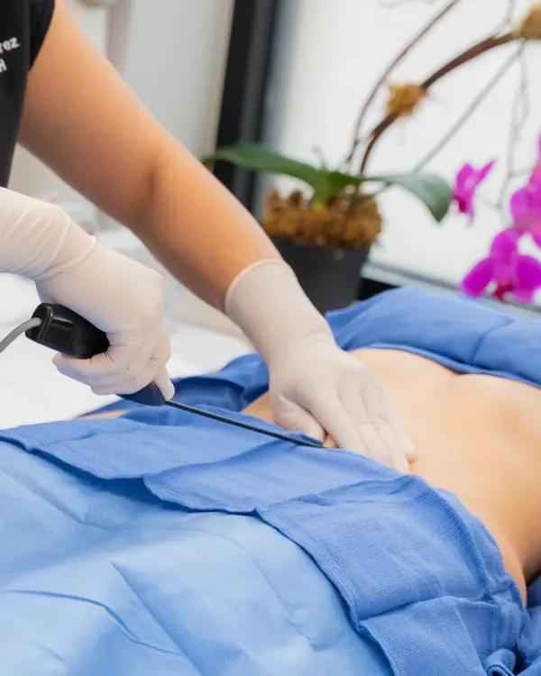 QuantumRF Luxora body contouring device