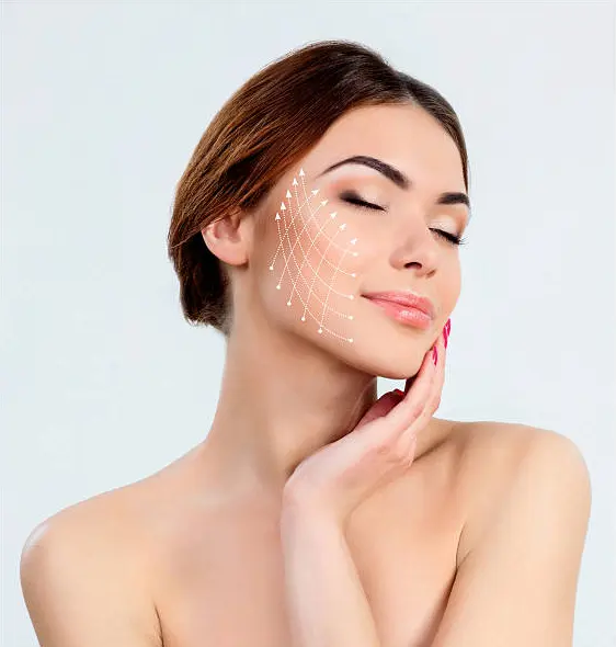 PDO thread lift treatment area